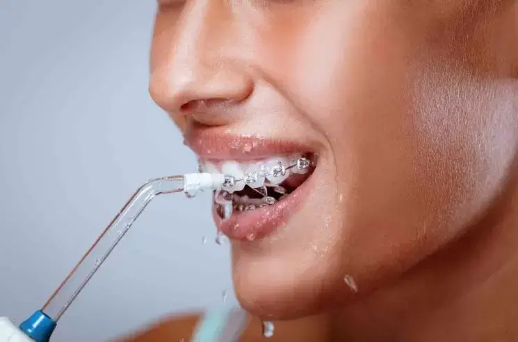 Que es un irrigador dental, bucal, u oral y para que sirve