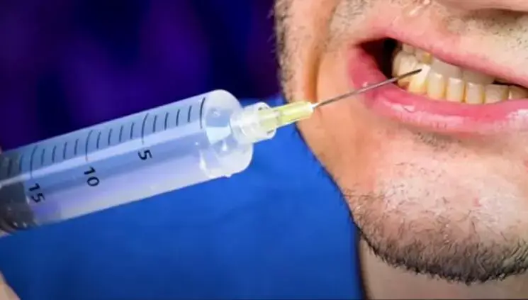 Cómo hacer un irrigador dental casero en casa